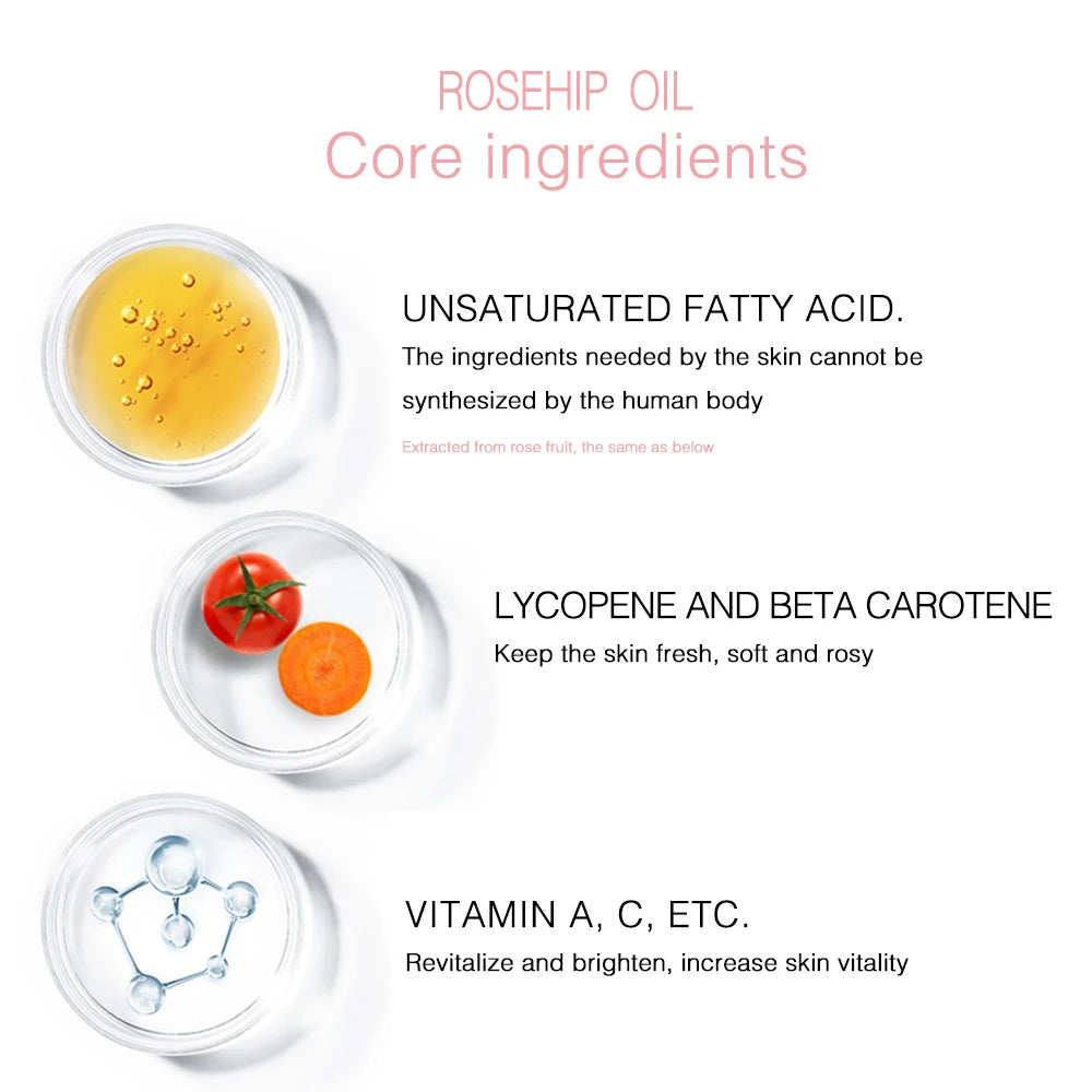Rosehip Seed Oil, 100% Pure Organic Unrefined Cold Pressed Anti Aging Rose Hip Moisturizer For Hair Skin & Nails