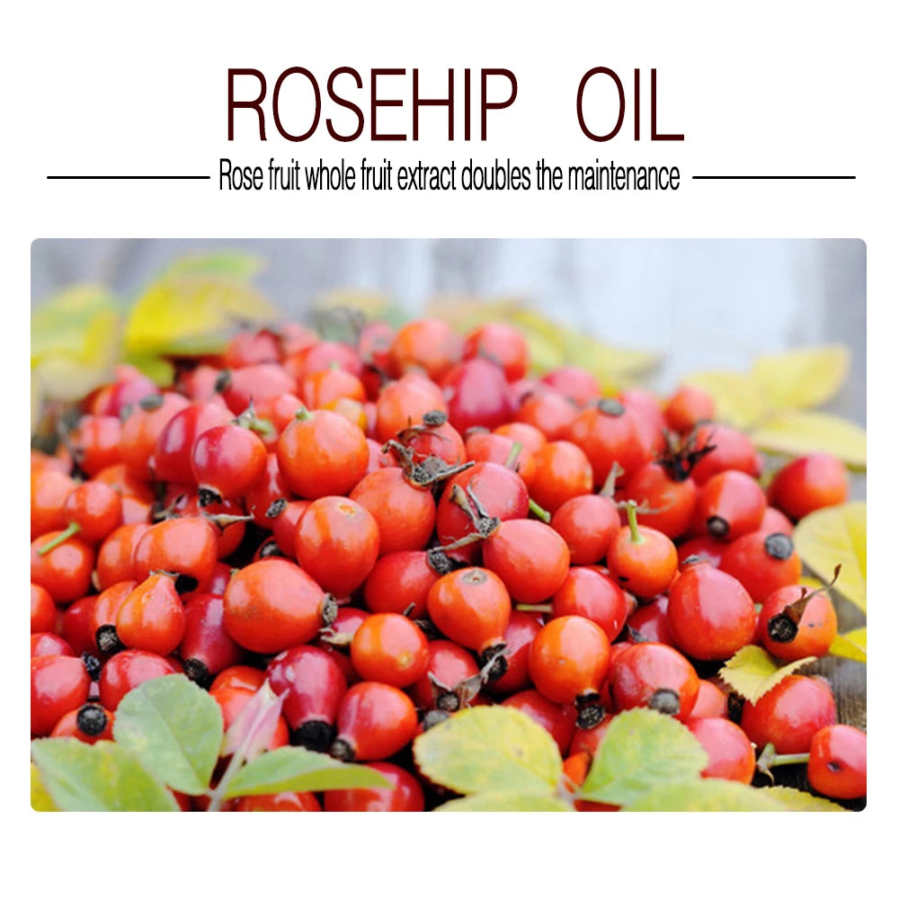Rosehip Seed Oil, 100% Pure Organic Unrefined Cold Pressed Anti Aging Rose Hip Moisturizer For Hair Skin & Nails