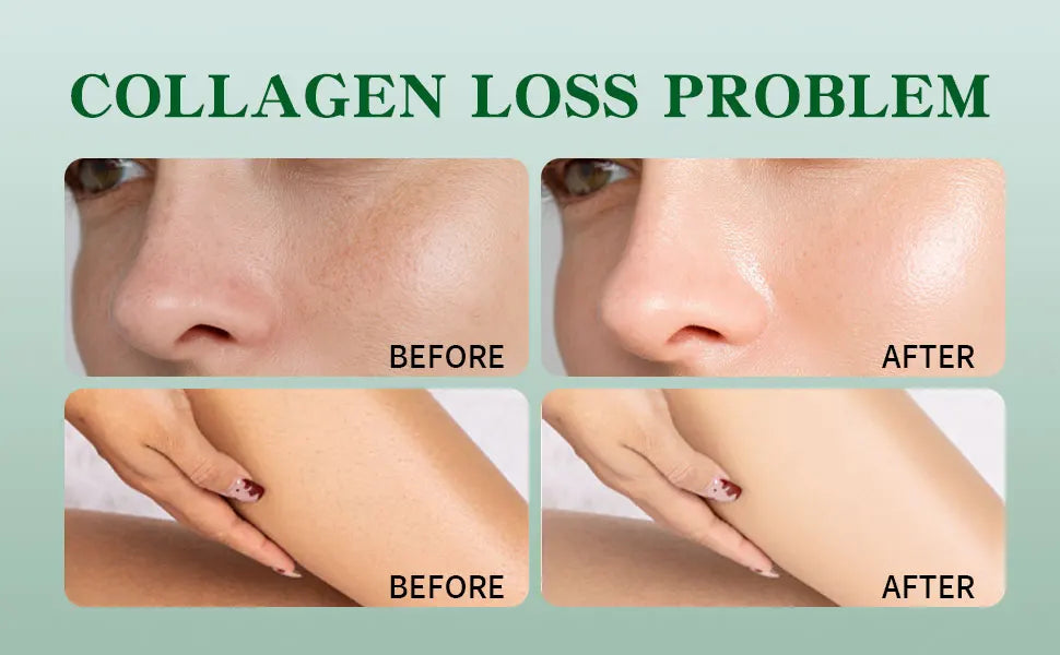 Collagen Lifting Body Oil, Hydrating & Firming Dry Oil, Lightweight Fast-Absorbing, after Shower Moisturizing Oil for Women & Men